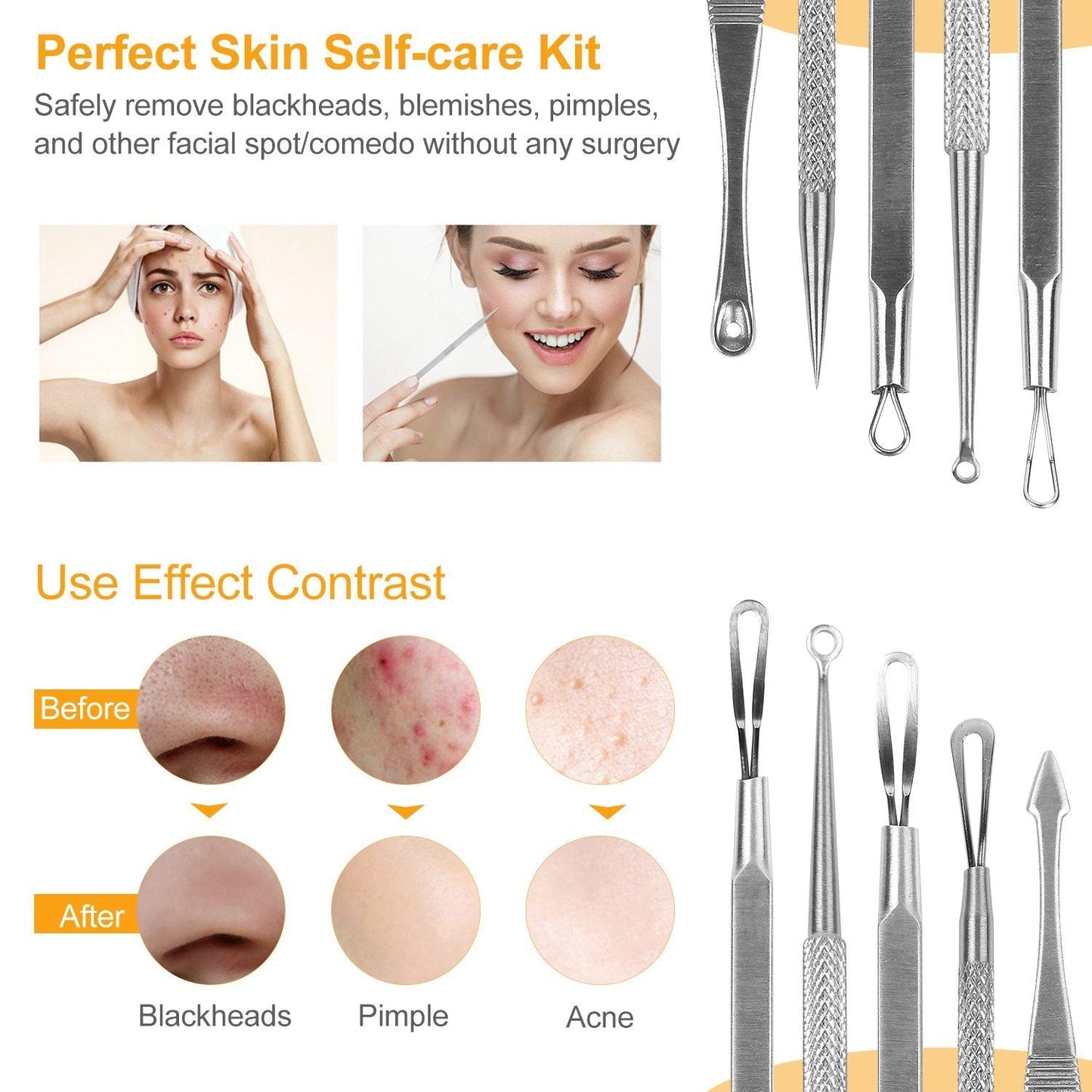 5-Pieces Set: BlackHead Remover Kit Pimple Comedone Extractor Tool Set