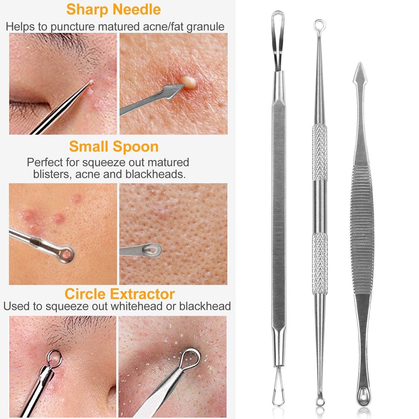 5-Pieces Set: BlackHead Remover Kit Pimple Comedone Extractor Tool Set