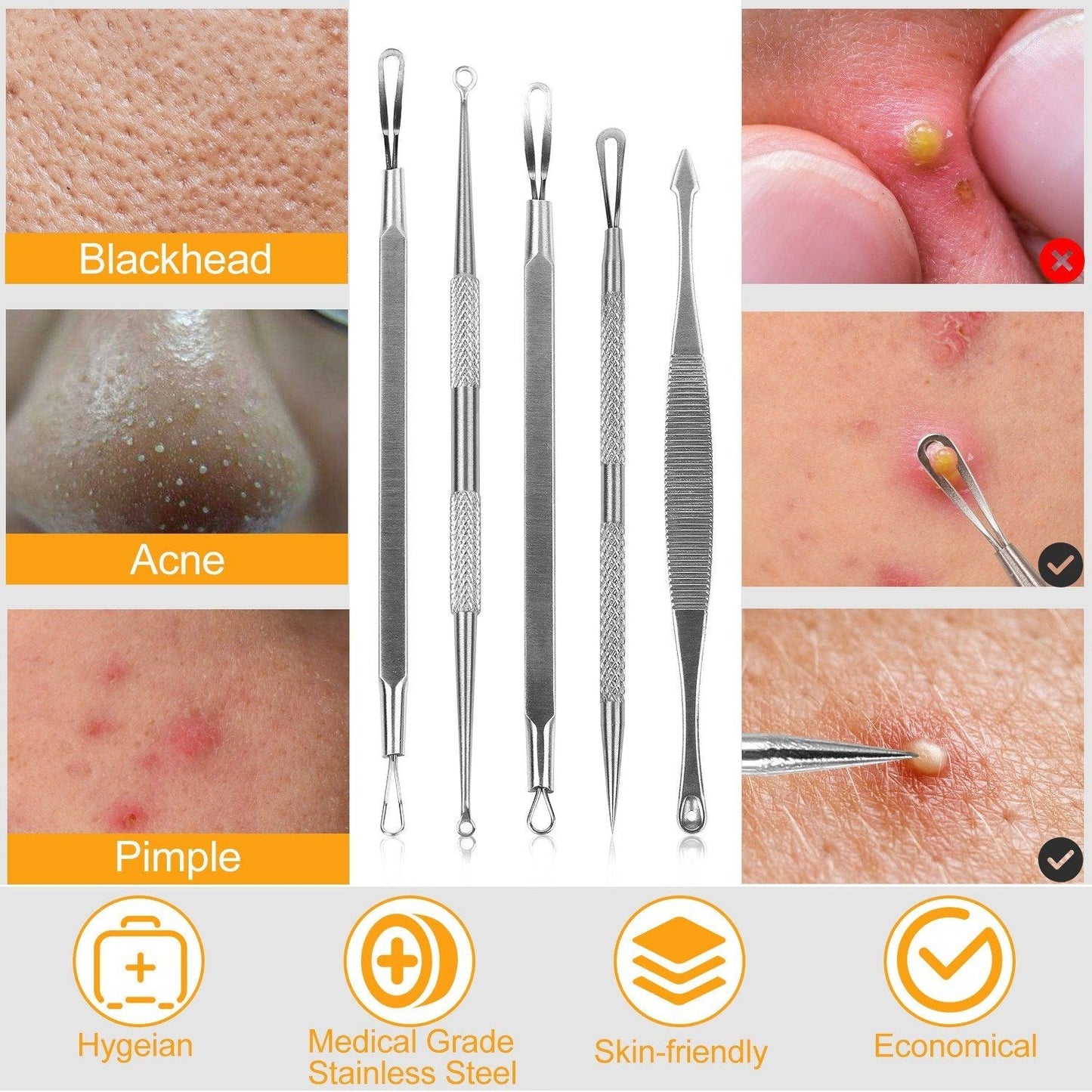 5-Pieces Set: BlackHead Remover Kit Pimple Comedone Extractor Tool Set