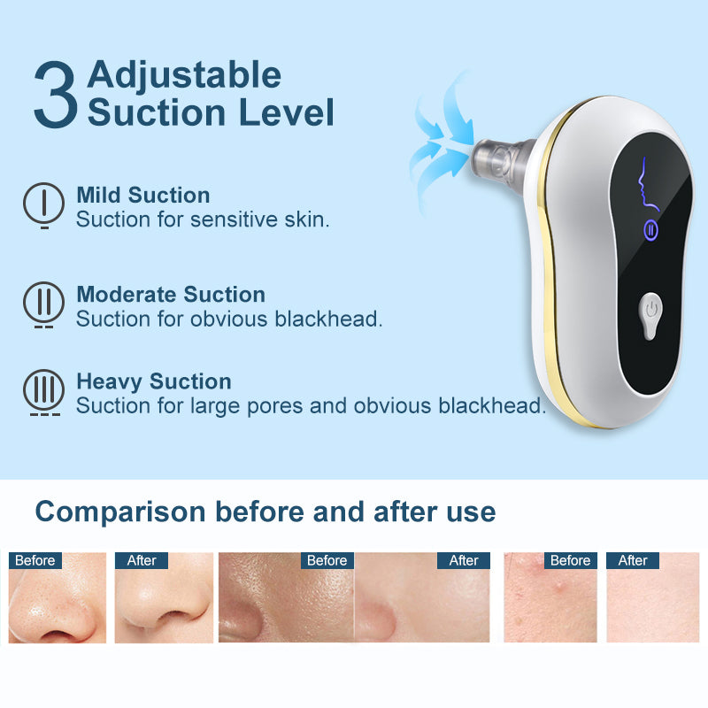 Electric Vacuum Blackhead & Acne Pore Cleaner