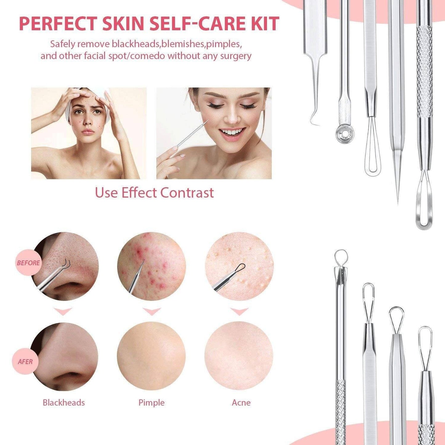 6-Pieces Set: Blackhead Remover Comedones Extractor Acne Removal Kit