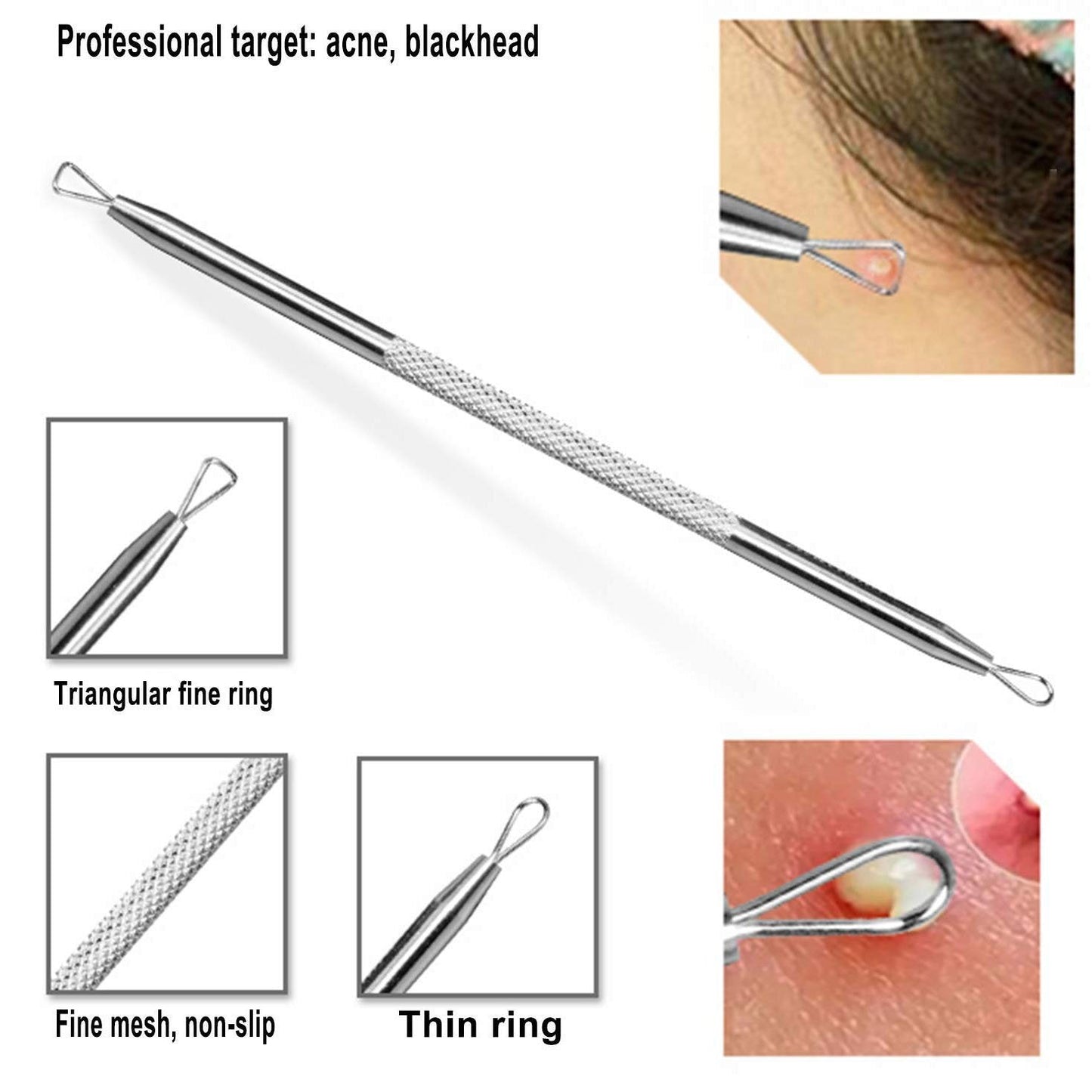 6-Pieces Set: Blackhead Remover Comedones Extractor Acne Removal Kit