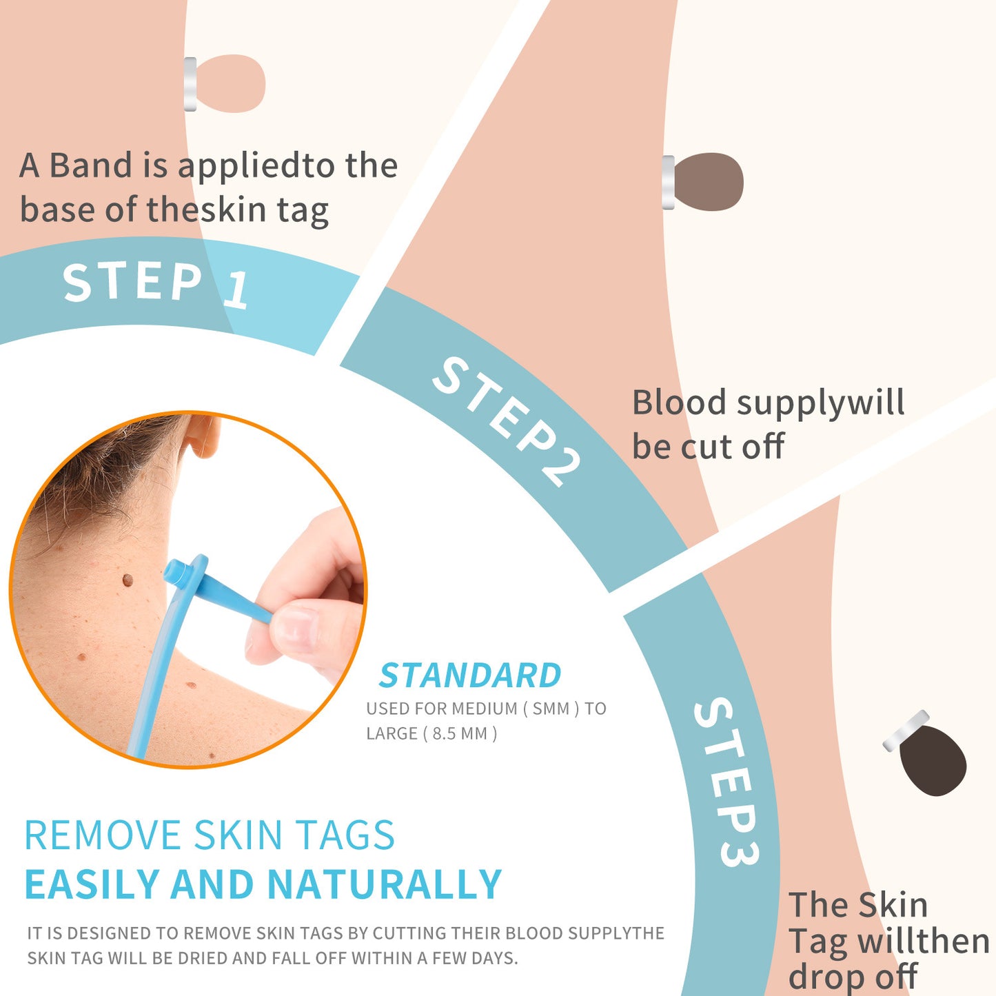 Skin Tag Remover