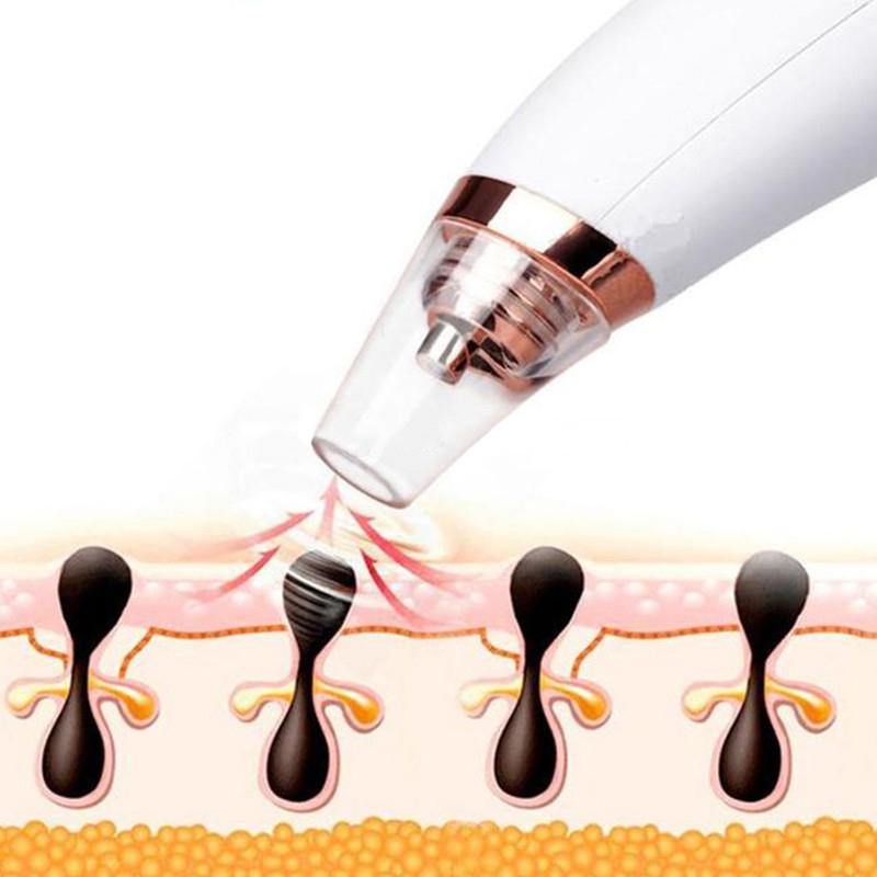 Visual Pore Cleaning Vacuum with Built in Camera